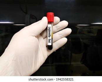 Blood Sample For Legionella (Legionnaires Disease) Test At Medical Laboratory.