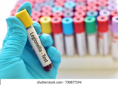 Blood Sample For Legionella (Legionnaires Disease) Test
