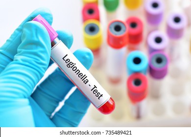 Blood Sample For Legionella (Legionnaires Disease) Test