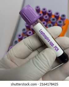 Blood Sample For Leptospira Spp. PCR Test To Identify Leptospirosis Caused By Leptospira Interrogans Bacteria.