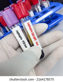 Blood Sample For Leptospira Test To Identify Leptospirosis Caused By Leptospira Interrogans Bacteria.