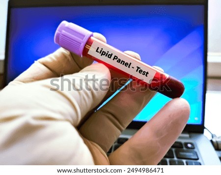 Blood sample for Lipid Panel test.