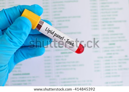 Blood sample for lipid panel test
