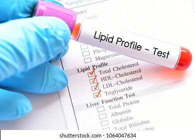Blood sample for lipid profile test