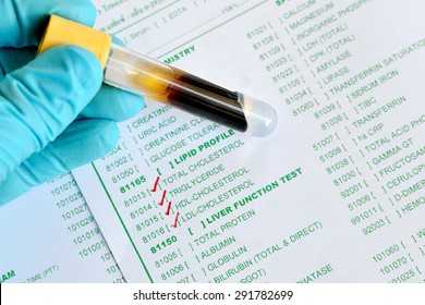 Blood Sample For Lipid Profile Testing