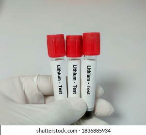 Blood Sample For Lithium Level. Healthcare/Medical Concept. This Test Help To Determine The Therapeutic Level When Just Starting Lithium Medication Or To Determine Lithium Toxicity.