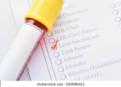 Test Tube Blood Sample Vitamin B12 Stock Photo 1059853325 | Shutterstock