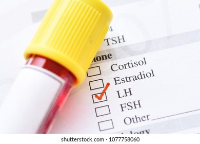 Blood Sample Luteinizing Hormone Lh Test Stock Photo 1077758060 