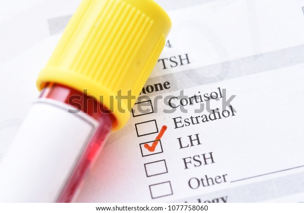 Blood Sample Luteinizing Hormone Lh Test Stock Photo Edit Now 1077758060