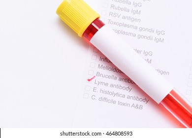 Blood sample for Lyme antibody test
