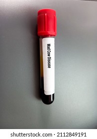 Blood Sample For Mad Cow Disease Or Bovine Spongiform Encephalopathy(BSE) Test. It's Another Called Variant Creutzfeldt-Jakob Disease(vCJD), CJD Prion Disease, Fatal Degenerative Brain Disorder