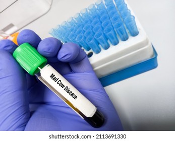 Blood Sample For Mad Cow Disease Or Bovine Spongiform Encephalopathy(BSE) Test. It's Another Called Variant Creutzfeldt-Jakob Disease(vCJD), CJD Prion Disease, Fatal Degenerative Brain Disorder