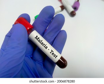 Blood Sample For Malaria Test