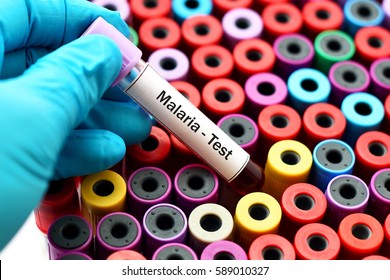 Blood Sample For Malaria Test