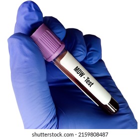 Blood sample for MDW (Monocyte distribution width) test for early detection of sepsis. Recent new sepsis biomarker, part of complete blood count, white background.