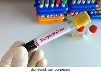 Blood Sample For Meningitis Viral Panel Test With Laboratory Background.