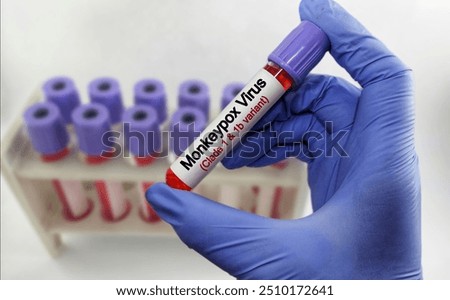 Blood sample for monkey pox virus (MPXV) test. Mpox (formerly known as monkeypox) is a disease caused by infection with a virus, known as Monkeypox virus. zoonotic disease.