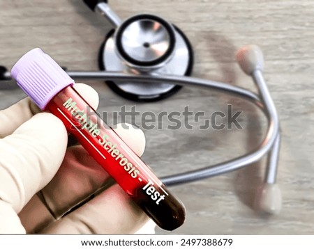 Blood sample for MS (Multiple Sclerosis) profile testing. Multiple Sclerosis disease test at medical laboratory.