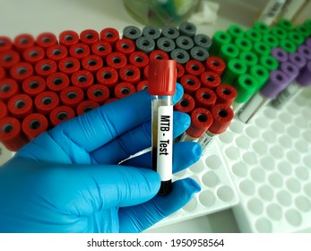 Blood Sample For Mycobacterium Tuberculosis (MTB) Test