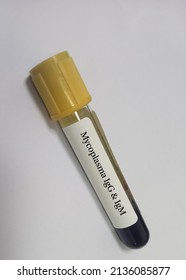 Blood sample for Mycoplasma IgG and IgM test to diagnosis mycoplasma infection.