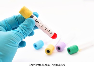 Blood Sample For Mycoplasma Test