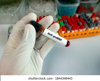 Blood Sample For N-terminal Pro B-type Natriuretic Peptide Or NT-proBNP Test, Cardiac Marker For Acute Or Chronic Heart Failure