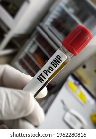 Blood Sample For N-terminal Pro B-type Natriuretic Peptide Or NT-proBNP Test, Cardiac Marker For Acute Or Chronic Heart Failure