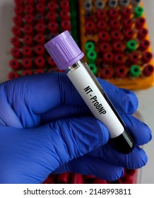 Blood sample for N-terminal pro B-type natriuretic peptide or NT-proBNP test, cardiac marker for acute or chronic heart failure, BTNP test, BNP test.