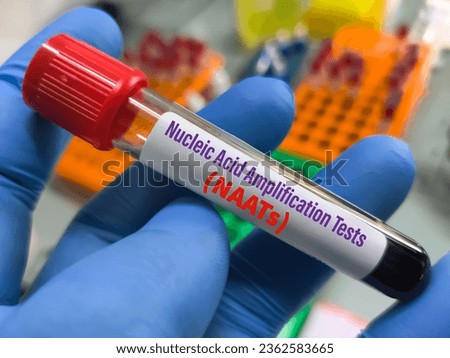 Blood Sample for Nucleic acid amplification tests (NAATs) at medical laboratory.