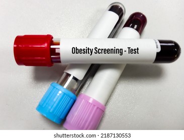 Blood Sample For Obesity Screening Test, Lipid Profile, Cholesterol, Triglyceride, LDL.