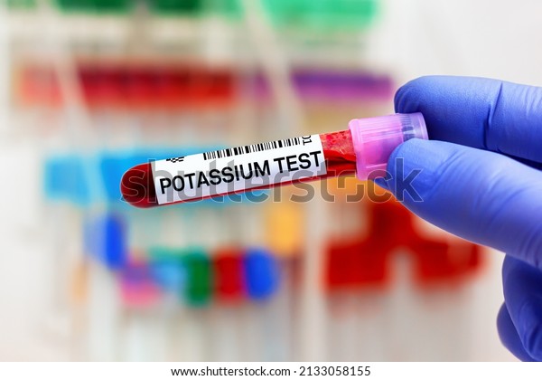 Blood sample of\
patient for Potassium test in laboratory. doctor with Blood tube\
and needle for Potassium\
test