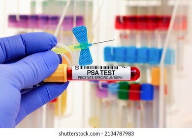 Blood sample of patient for PSA Free and PSA Total tests in laboratory. doctor with Blood tube and catheter for PSA Prostate specific antigen test in biochemistry lab