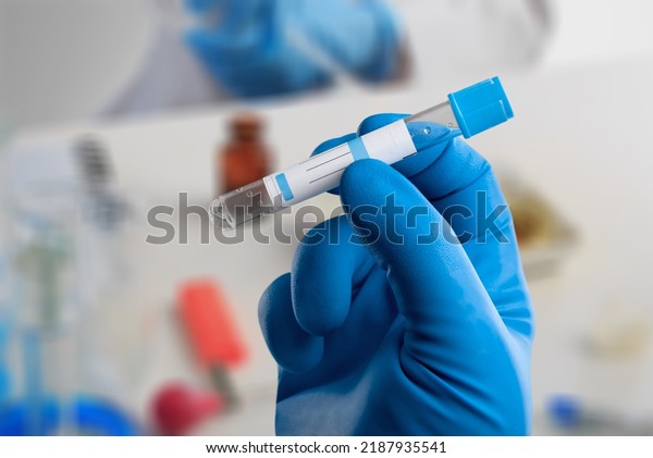 Blood Sample Patient Test Laboratory Doctor Stock Photo 2187935541 ...