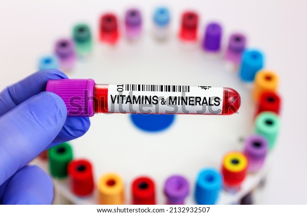 Blood sample of patient for Vitamins and minerals\
test in laboratory. doctor with Blood tube for Vitamins and\
minerals test in lab