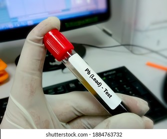 Blood Sample For Pb (Lead) Test. Blood Toxicity Testing