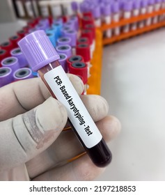 Blood Sample For PCR Based Karyotyping Testing. Genetic Disorder. Chromosomal Analysis.