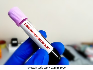 Blood Sample For PCR Detection Of Listeria Monocytogenes. Listeriosis.