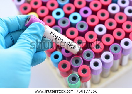 Blood sample for Plague test, infectious disease caused by the bacteria Yersinia pestis