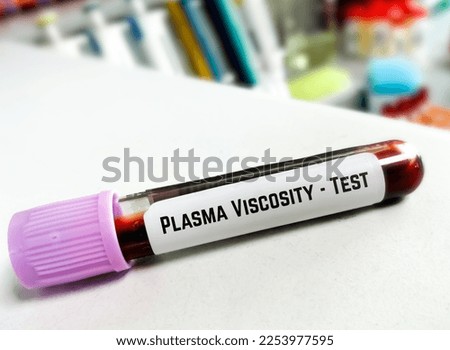 Blood sample for Plasma Viscosity test, Diagnosis for Polymyalgia rheumatica, giant cell arteritis or temporal arteritis, such as headaches, neck or shoulder pain, pelvic pain, joint stiffnes.