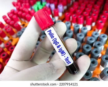 Blood Sample For Polio Virus IgG And IgM.