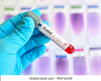 Blood Sample Positive With Alcohol Testing
