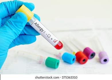 Blood Sample Positive With Allergy Testing