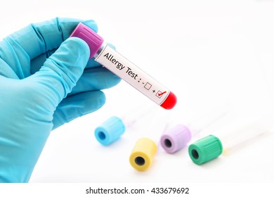 Blood Sample Positive With Allergy Testing