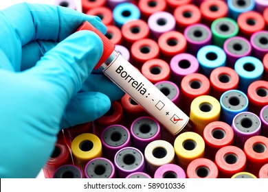 Blood sample positive with Borrelia test, Lyme disease diagnosis