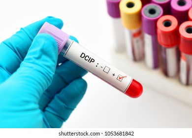 Blood Sample Tube Homocysteine Test Diagnosis Stock Photo (Edit Now ...