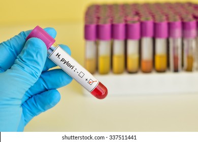 Blood Sample Positive With Helicobacter Pylori (H.pylori)