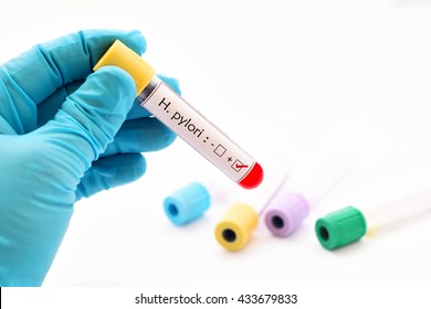 Blood Sample Positive With Helicobacter Pylori (H.pylori)