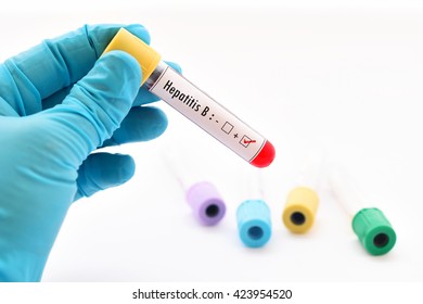 Blood Sample Fluorescence Situ Hybridization Fish Stock Photo ...