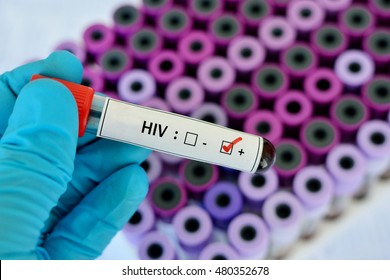 Blood Sample Positive With HIV Testing