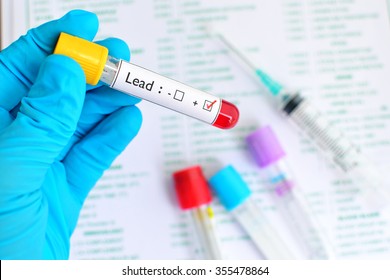 Blood Sample Positive With Lead Metal